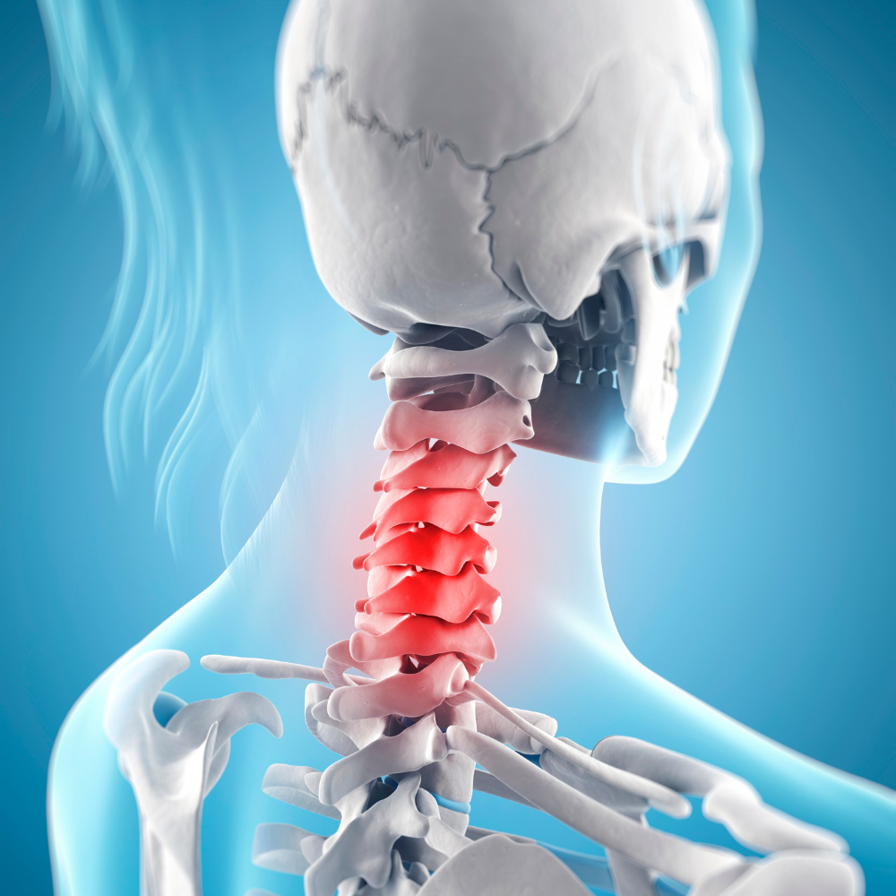 cervical pain Alicante